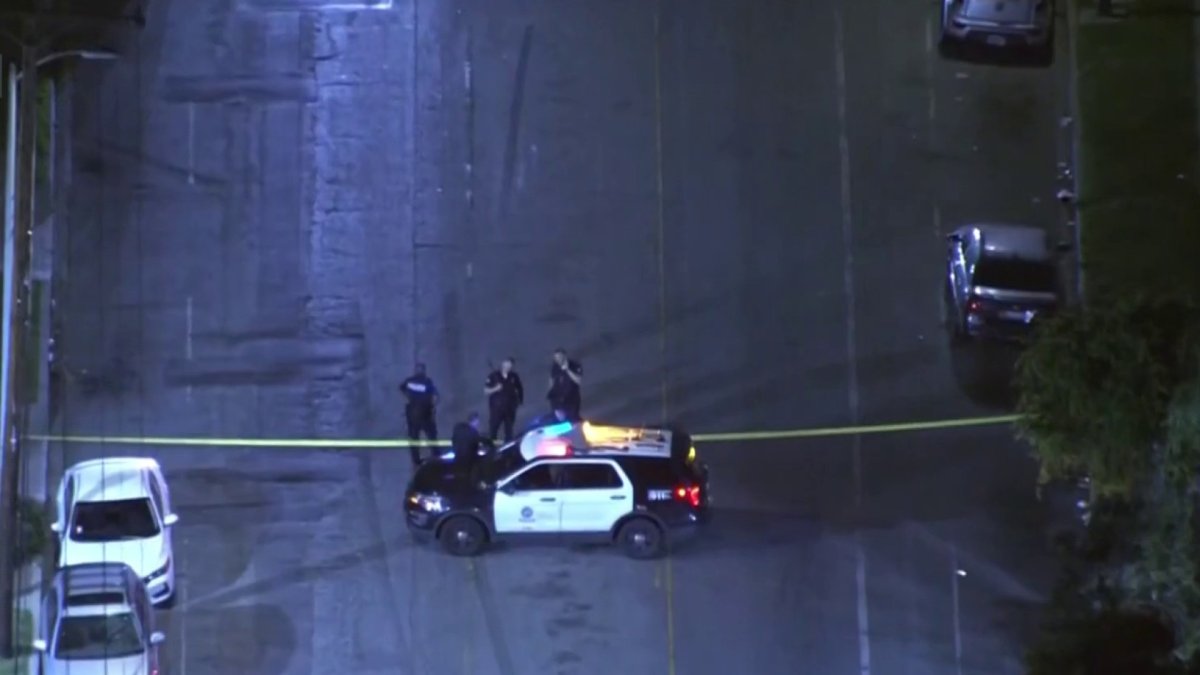 South LA teen hospitalized after being shot in the head – NBC Los Angeles