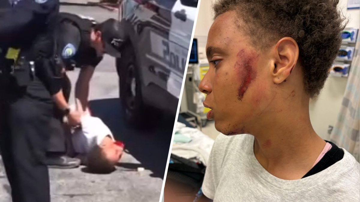 San Bernardino Officer Body-Slams Handcuffed Teenager Amid Abuse Claims