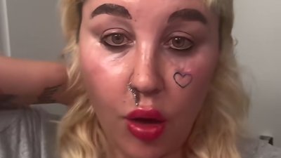 Amanda Bynes reveals Ozempic plans to ‘look better in paparazzi pictures'