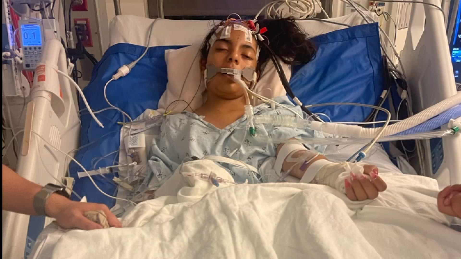 Homicide probe after girl killed in alleged bullying in Reseda – NBC Los Angeles