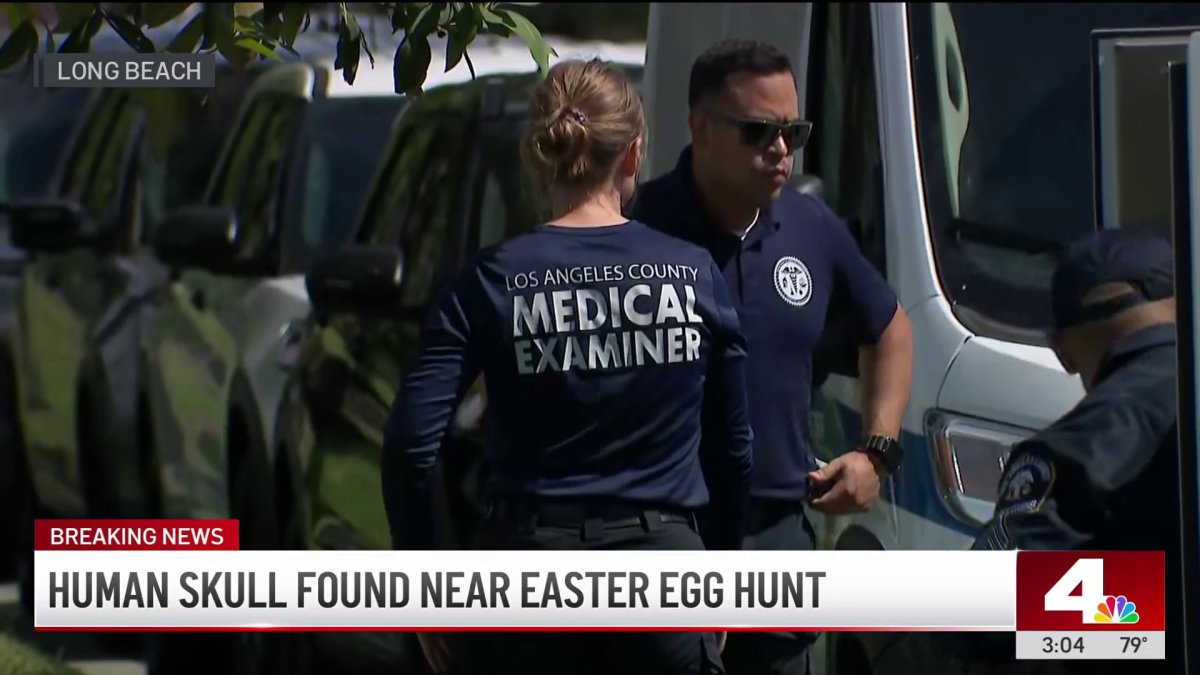 Human skull found in Long Beach – NBC Los Angeles