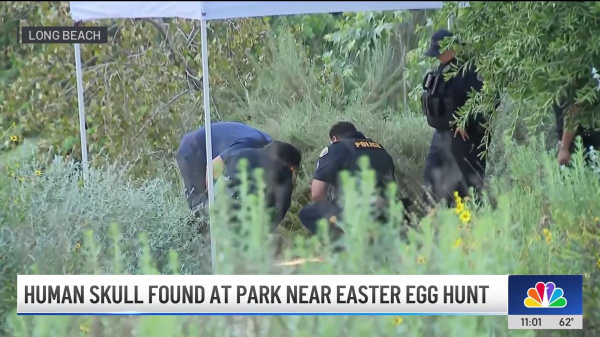 Human remains found at Long Beach park disturbs residents – NBC Los Angeles