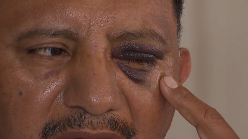 Eliu Ramirez, an ice cream vendor, speaks with NBCLA on Wednesday, July 8, 2026, about his assault that happened on the Fourth of July.