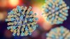 Two die of measles in Pennsylvania outbreak