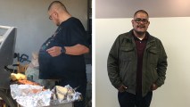 Hector Hernandez thought his large gut, as seen in the image to the left, was just fat that wouldn