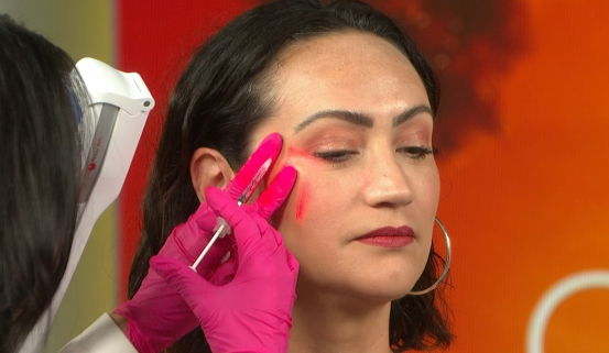 What is Baby Botox? Dr. Tess Explains