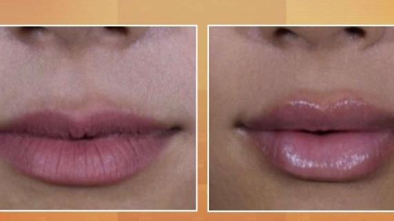 Tuesdays with Dr. Tess: A Plumper Pout