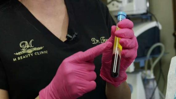 Tuesdays with Dr. Tess: Regain Your Hair and Confidence